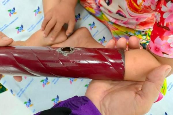 Bé gái 1 tuổi tử vong bất thường nghi do uống nhầm xăng-2