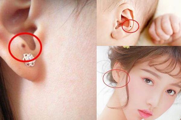 Phụ nữ sở hữu nốt ruồi ở 5 vị trí vàng này thì cuộc đời chỉ từ may mắn đến giàu có, ai lấy được phúc đức 3 đời-6