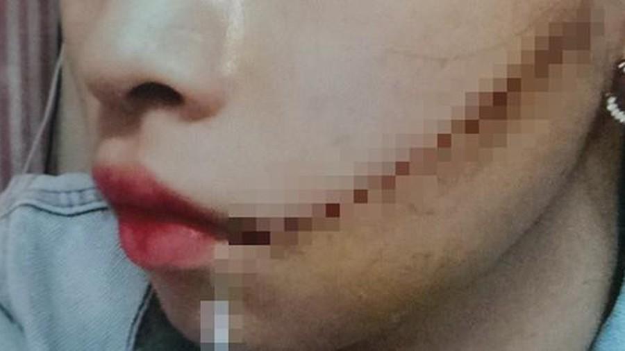 Chỉ vì một câu thách thức, cô vợ bị chồng hờ tặng quà hàng chục nhát rạch mặt-1