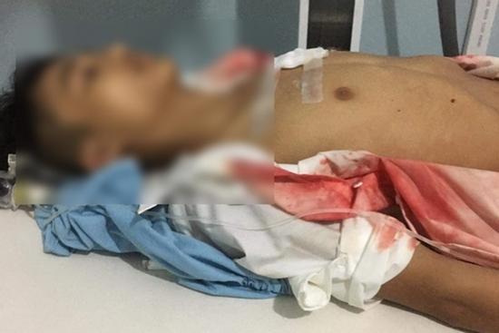 Mâu thuẫn học đường, nam sinh lớp 11 bị đàn anh lớp trên đâm thấu ngực