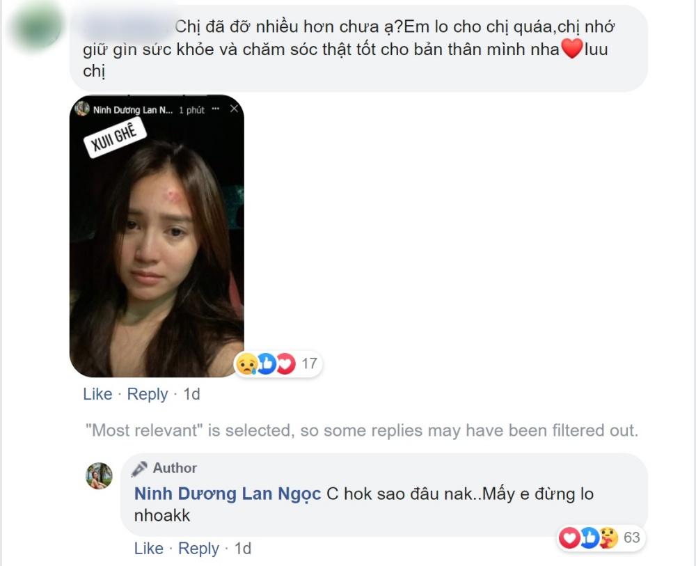 Fan xót xa khi Lan Ngọc u đầu mẻ trán trên phim trường-7