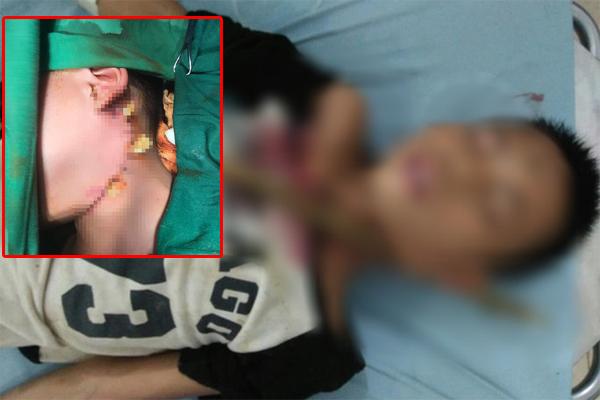 Clip: Bị đá sau va chạm, thanh niên cay cú đè đầu đối phương giữa đường-3