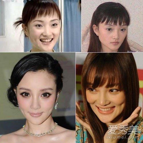 Người đẹp cắm sừng Lý Tiểu Lộ bị nghi nghiện phẫu thuật thẩm mỹ-7