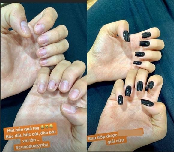 Kỳ Duyên bị bật cả móng chân khi tham gia thử thách bộ đội nhập ngũ-7