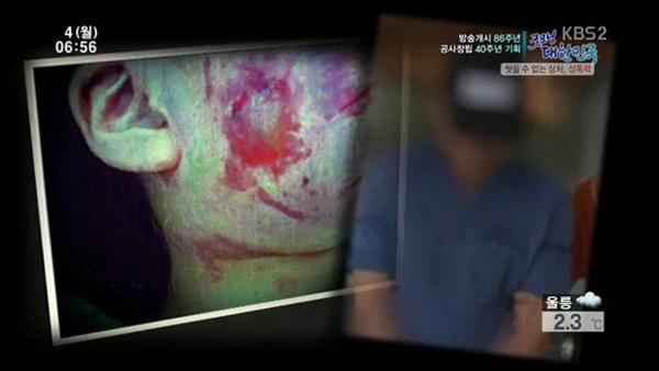 Bố bé gái vụ ấu dâm chấn động Hàn Quốc: Con tôi vẫn mặc tã, trang bị bộ đàm phòng trường hợp khẩn cấp-2