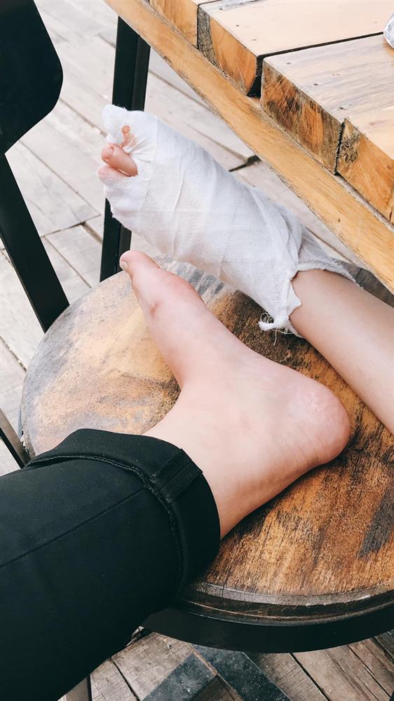 Khách du lịch tố quán bánh tráng nướng nổi tiếng Đà Lạt đuổi khách đang bị đau chân-2