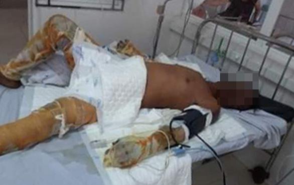 Bé trai bị bỏng nặng trong vụ phóng hỏa đốt nhà ở Phú Yên: Bà ngoại ơi... cứu con-2