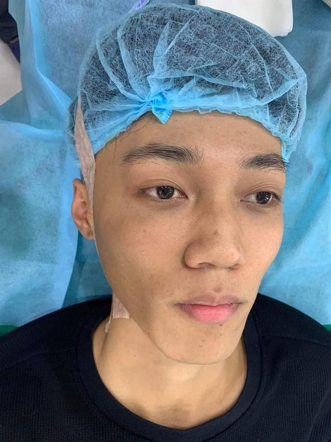 Chàng trai 19 tuổi chi 70 triệu đồng phẫu thuật thẩm mỹ-1