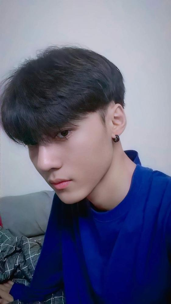 Chàng trai 19 tuổi chi 70 triệu đồng phẫu thuật thẩm mỹ-4