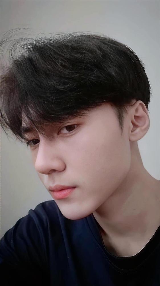 Chàng trai 19 tuổi chi 70 triệu đồng phẫu thuật thẩm mỹ-5