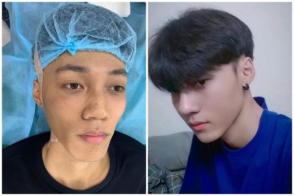 Mặt trái về phẫu thuật thẩm mỹ ở showbiz Trung Quốc-6