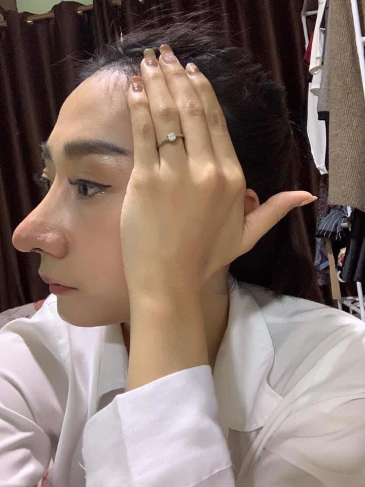 Pha phẫu thuật nâng mũi như phù thủy gây xôn xao mạng xã hội-1