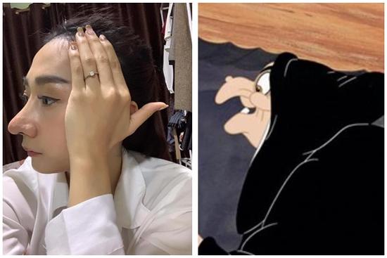 Pha phẫu thuật nâng mũi như phù thủy gây xôn xao mạng xã hội