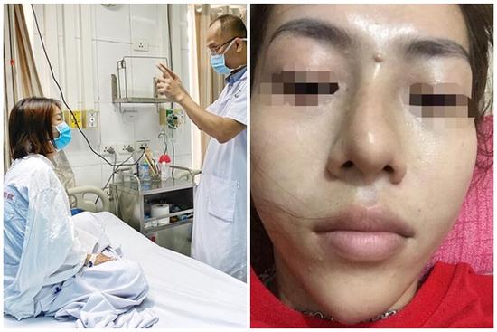 Tiêm filler nâng mũi, nữ nhân viên ngân hàng ở Thái Nguyên suýt mù mắt