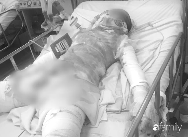 Thương tâm: Thiếu nữ bị bỏng 95%, nghi do bạn trai tưới xăng đốt tại vườn cao su Bình Dương-1