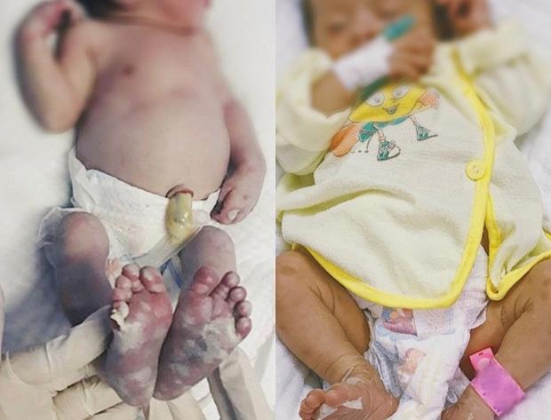 Bé sơ sinh ở Nghệ An mắc bệnh giang mai bẩm sinh nghi do lây từ mẹ-1