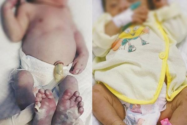 Quan hệ tình dục vô độ, nam thanh niên mắc cả bệnh giang mai lẫn hột xoài-4