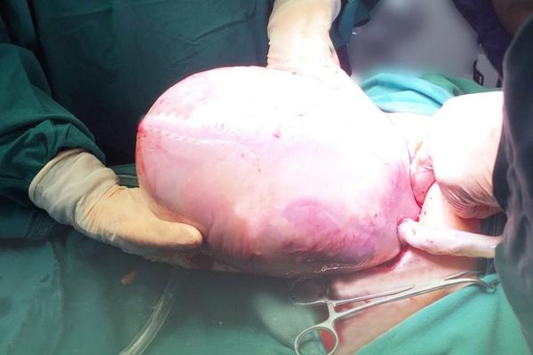 HI HỮU: Bé sơ sinh ở Quảng Ninh mắc bệnh lạ, toàn thân khô cứng như sa mạc-3