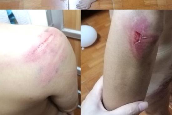 Vay nặng lãi, con nợ bị côn đồ đưa về trụ sở công ty rồi đánh đập dã man
