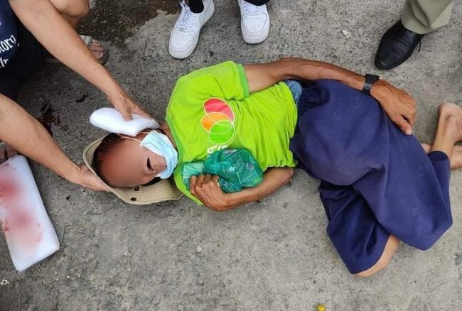 TP.HCM: Phẫn nộ gã đàn ông tông xe làm người bán vé số tật nguyền chấn thương nặng rồi bỏ chạy-1