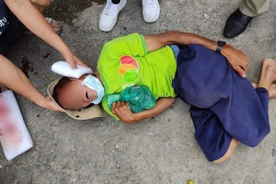 TP.HCM: Phẫn nộ gã đàn ông tông xe làm người bán vé số tật nguyền chấn thương nặng rồi bỏ chạy