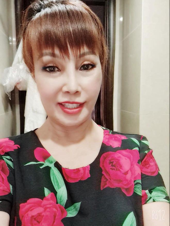 Cô dâu Cao Bằng lộ mặt méo xệch sau thẩm mỹ khiến người đối diện cứ nhìn là sợ-5