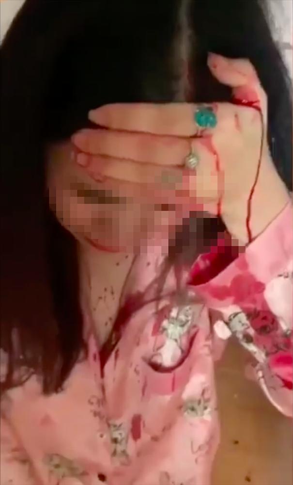 Đánh ghen chấn động Bắc Giang: Tiểu tam chảy máu đầm đìa, quỳ lạy van xin vẫn nhừ đòn-2