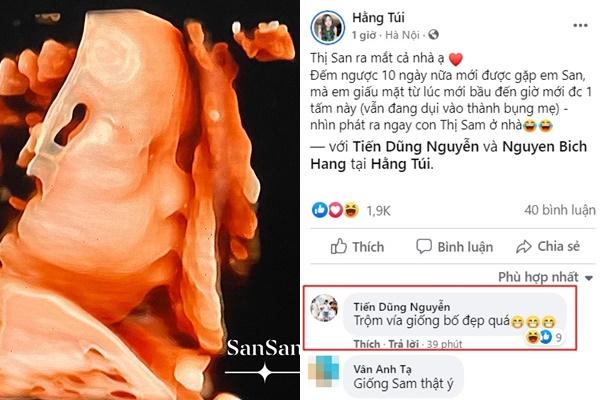 Hằng Túi khoe hình siêu âm con thứ 5, ông xã kiến trúc sư thả comment gây chú ý-1