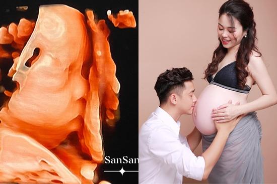 Hằng 'Túi' khoe hình siêu âm con thứ 5, ông xã kiến trúc sư thả comment gây chú ý