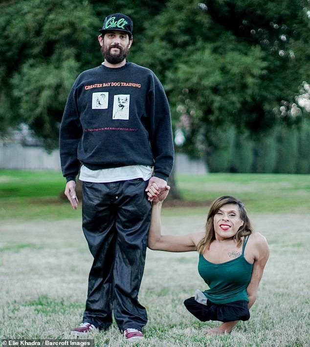 Yêu cô gái chuyển giới chỉ có một nửa thân, chàng trai tiết lộ đời sống tình dục bất ngờ-1