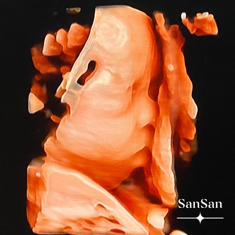 Hằng Túi ôm bụng đi đẻ lần 5, bức ảnh do ông xã chụp từ phía sau gây lú người xem-5