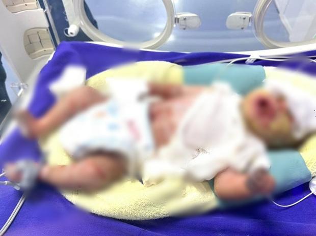 HI HỮU: Bé sơ sinh ở Quảng Ninh mắc bệnh lạ, toàn thân khô cứng như sa mạc-2