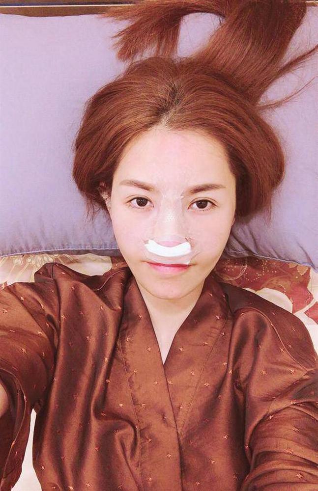 Những sao Việt dao kéo nhiều đến mức đếm quá cả 2 bàn tay-10