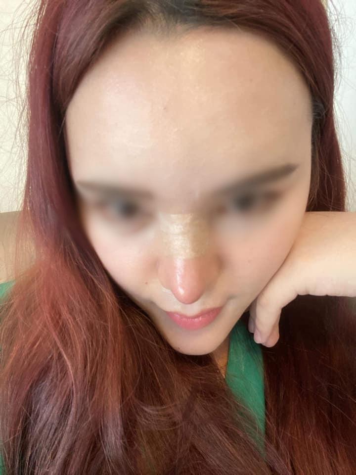 Pha nâng mũi kì quặc, cộng đồng mạng ví như cầu trượt-1