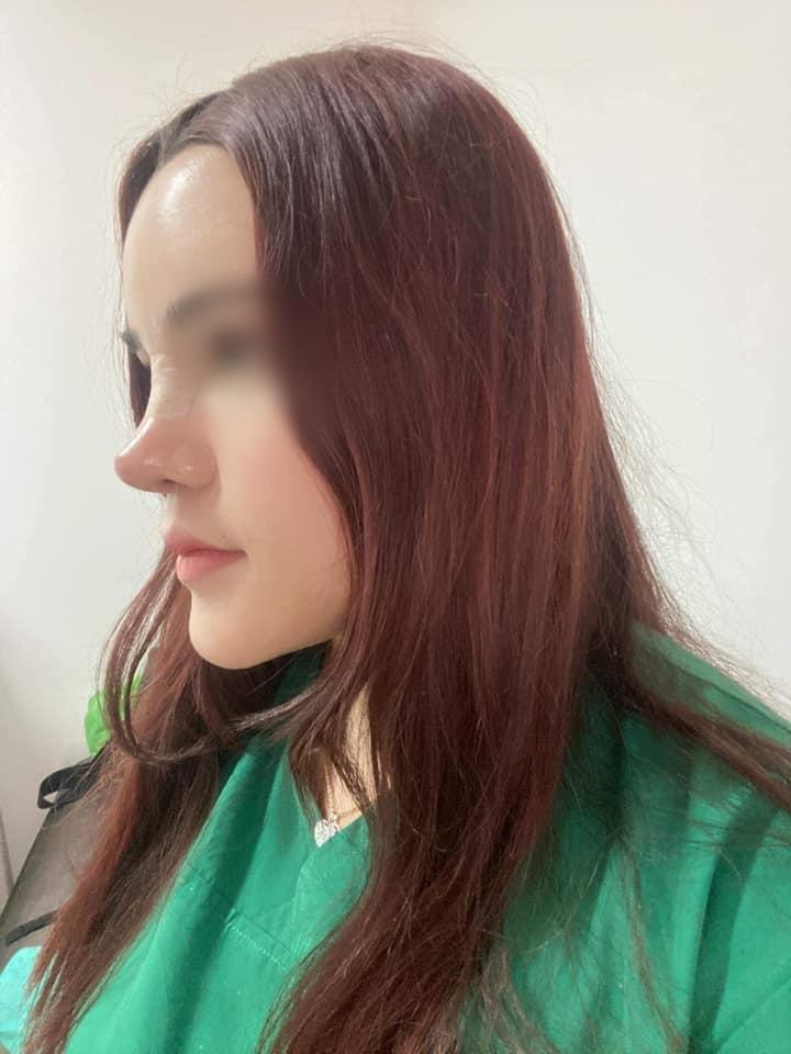 Pha nâng mũi kì quặc, cộng đồng mạng ví như cầu trượt-2