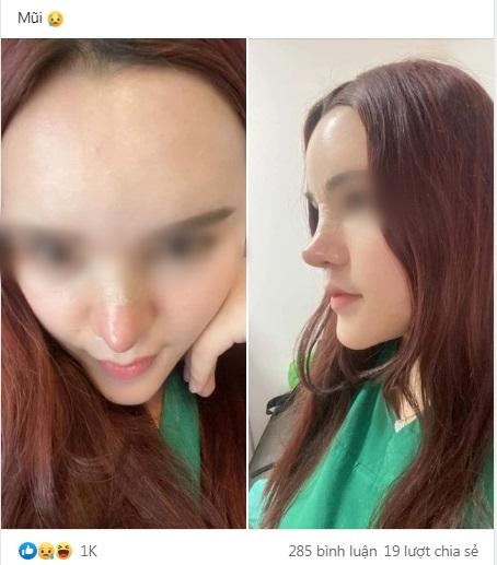 Pha nâng mũi kì quặc, cộng đồng mạng ví như cầu trượt-3