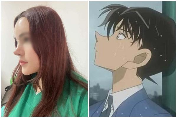 Pha nâng mũi kì quặc, cộng đồng mạng ví như cầu trượt-6