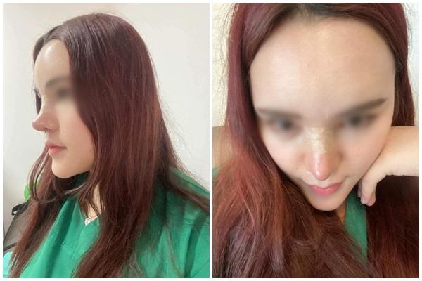 5 thành phần trong mỹ phẩm có thể gây ung thư-10