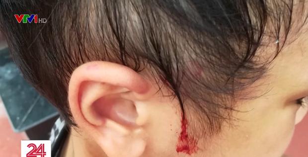 Bé 9 tuổi bị bố bạo hành: Trong mơ con vẫn thấy mình bị đánh-1