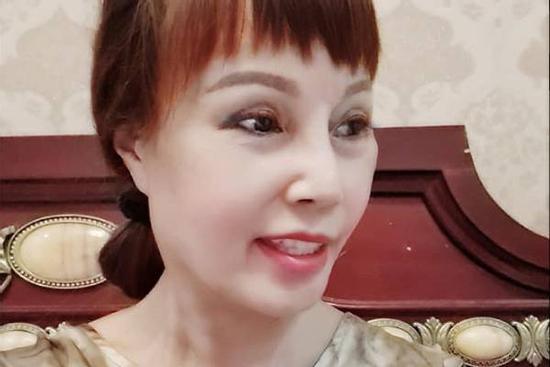 Cô dâu 63 tuổi tiếp tục lộ miệng méo đáng sợ dù nhập viện điều trị biến chứng thẩm mỹ