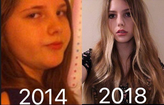 Nàng mập 93 kg lột xác nhờ ăn Keto-1