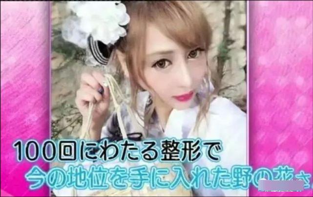 Mẫu nữ Nhật Bản phẫu thuật thẩm mỹ 100 lần vì bị chê giống khỉ đột-7