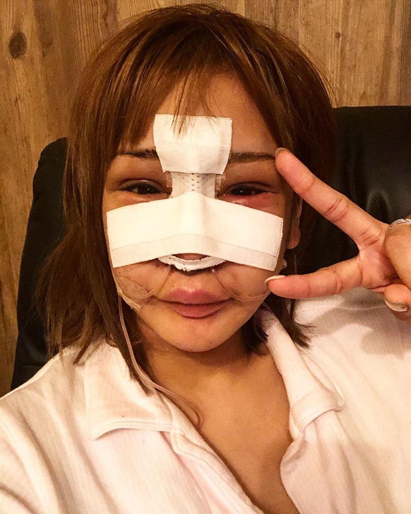 Mẫu nữ Nhật Bản phẫu thuật thẩm mỹ 100 lần vì bị chê giống khỉ đột-2