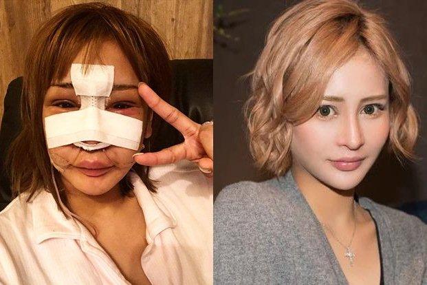 Bí quyết sống lâu của người dân ngôi làng trường thọ ở Nhật-7