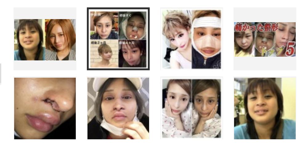 Mẫu nữ Nhật Bản phẫu thuật thẩm mỹ 100 lần vì bị chê giống khỉ đột-3