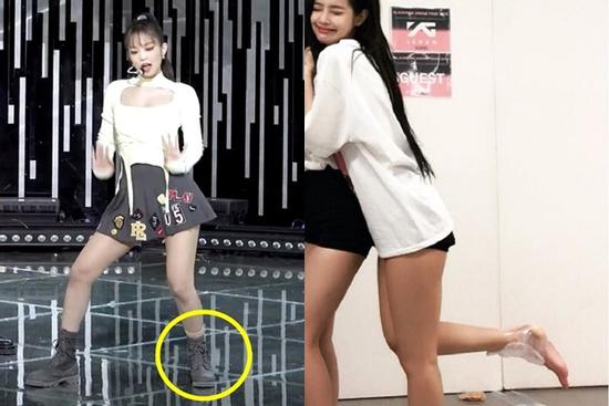 Jennie chấn thương mắt cá, BLACKINK comeback liên tục liệu có đúng đắn?