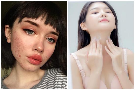 5 thành phần trong mỹ phẩm có thể gây ung thư