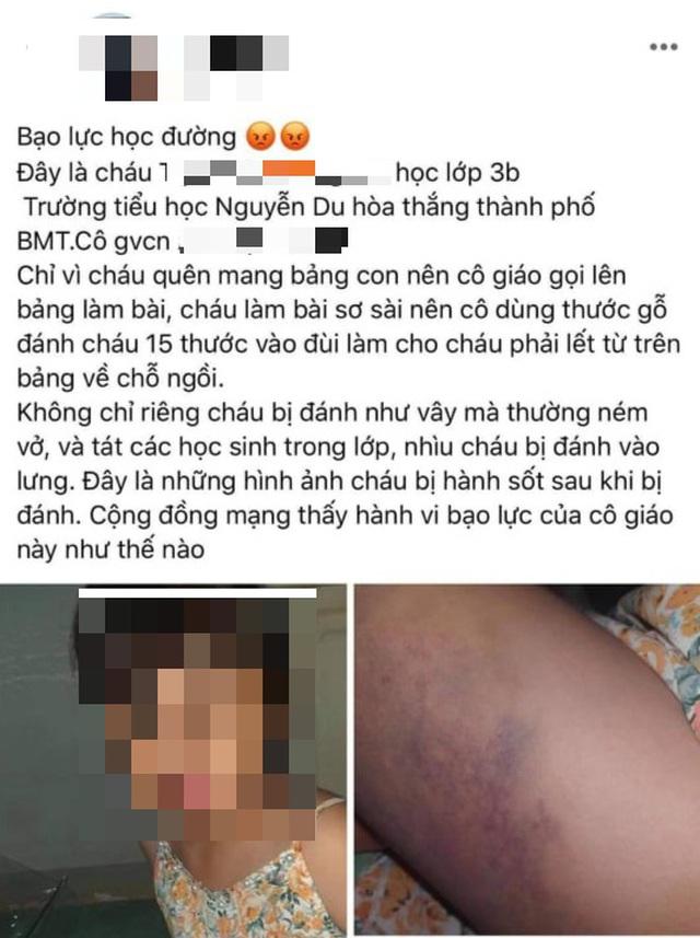Bé lớp 3 bị cô giáo đánh bầm tím đùi, phải lết từ bảng về chỗ ngồi?-1