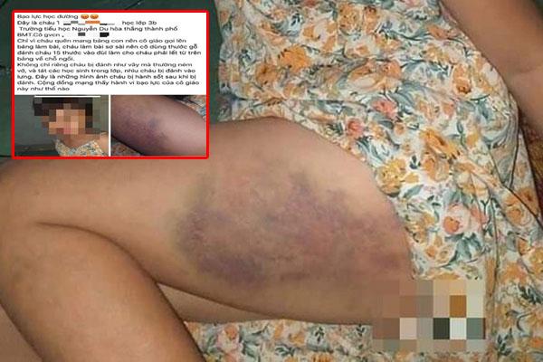 Bài Toán lớp 1 gây tranh cãi: Cho 4 cam chín, 3 cam xanh. Hỏi điền phép trừ nào hợp lý?-2