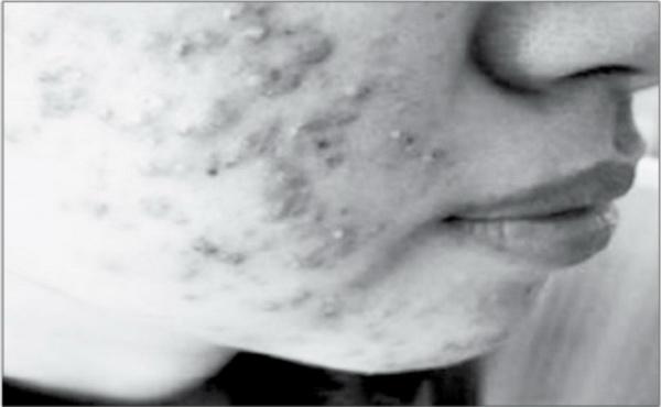 Mua kem trộn làm trắng da qua mạng xã hội: Người sử dụng lãnh đủ hậu quả-2